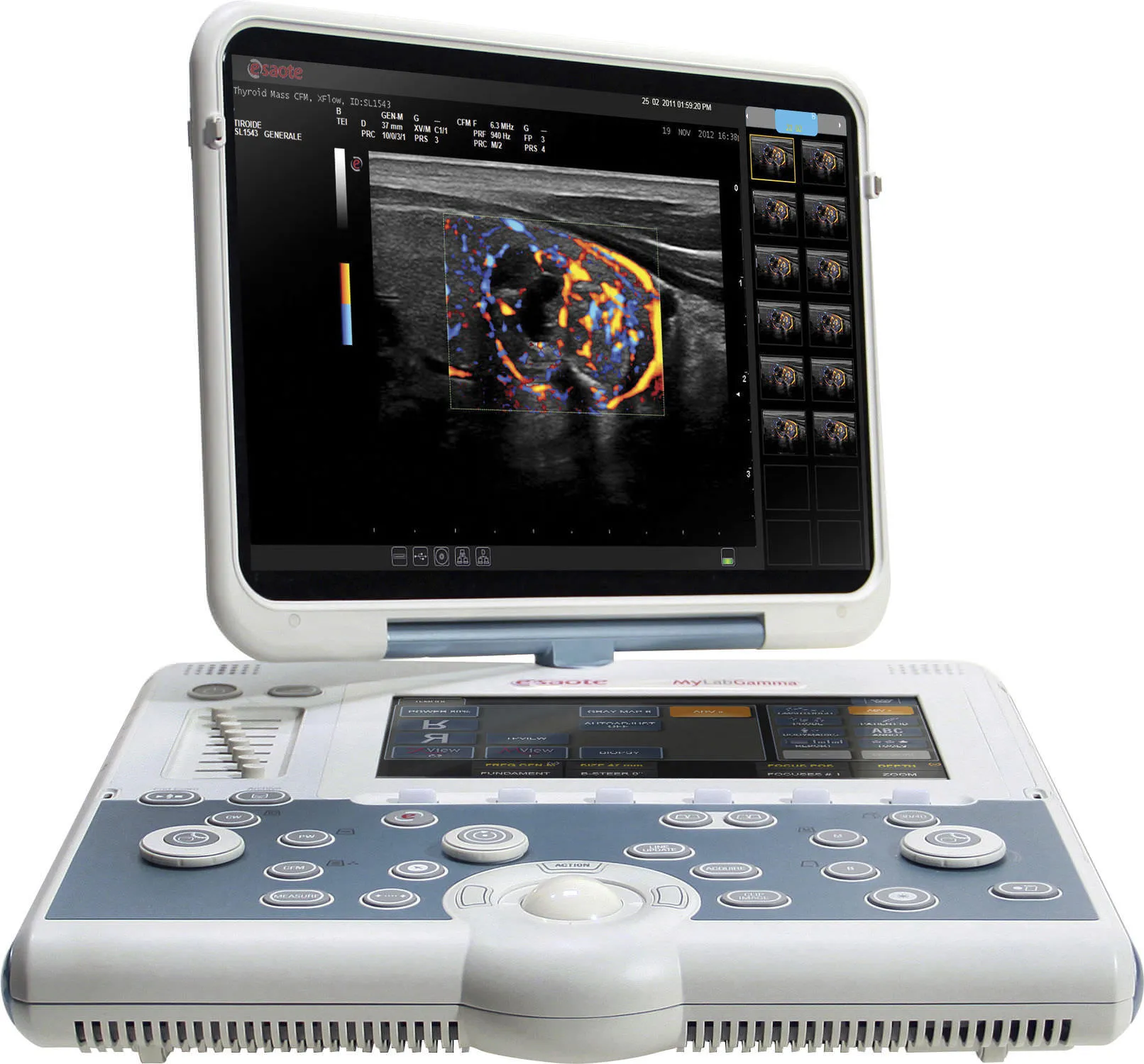 esaote mylab gamma ultrason cihazi tamiri esaote mylab gamma ultrason cihazı tamiri