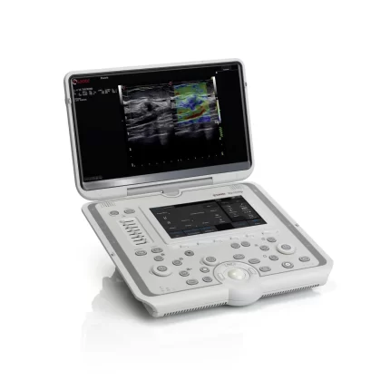 esaote mylab omega ultrason cihazi tamiri