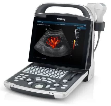 mindray dp30 ultrasonografi cihazı tamiri
