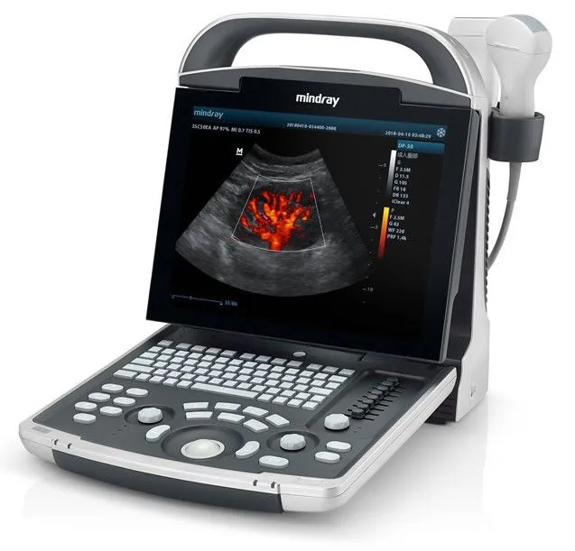 mindray dp30 ultrasonografi cihazi tamiri mindray dp30 ultrasonografi cihazı tamiri