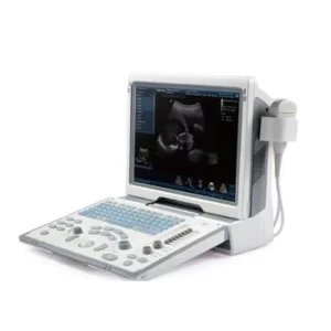 Sonosite M-Turbo Ultrasonografi Cihazı Tamiri