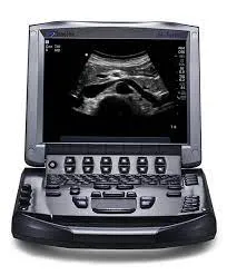 sonosite m-turbo ultrasonografi cihazı tamiri